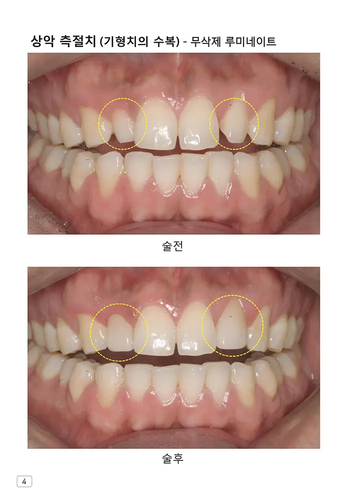 라인치과기공 임상사례집 수록 이미지 4