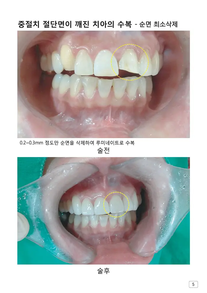 라인치과기공 임상사례집 수록 이미지 5