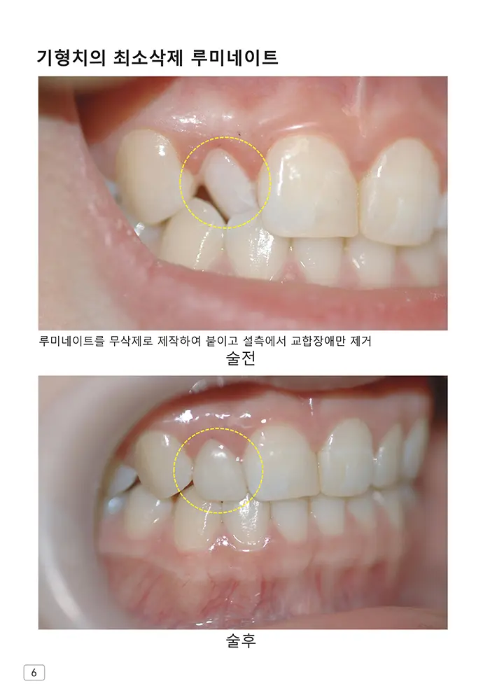 라인치과기공 임상사례집 수록 이미지 6