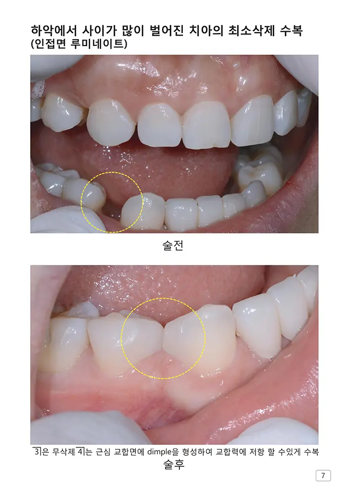 라인치과기공 임상사례집 수록 이미지 7