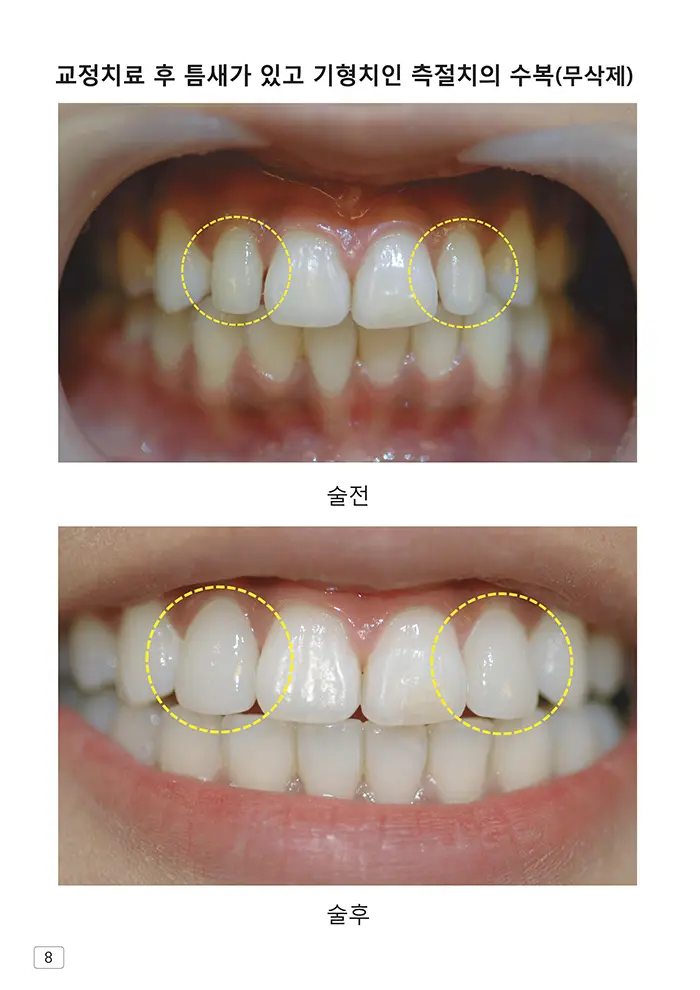 라인치과기공 임상사례집 수록 이미지 8