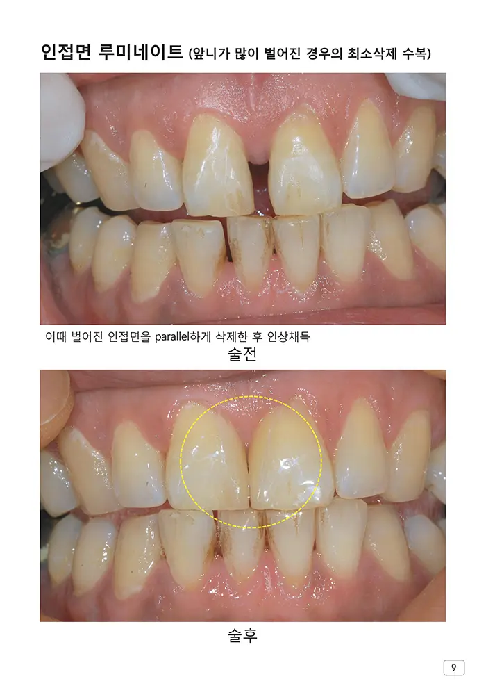 라인치과기공 임상사례집 수록 이미지 9