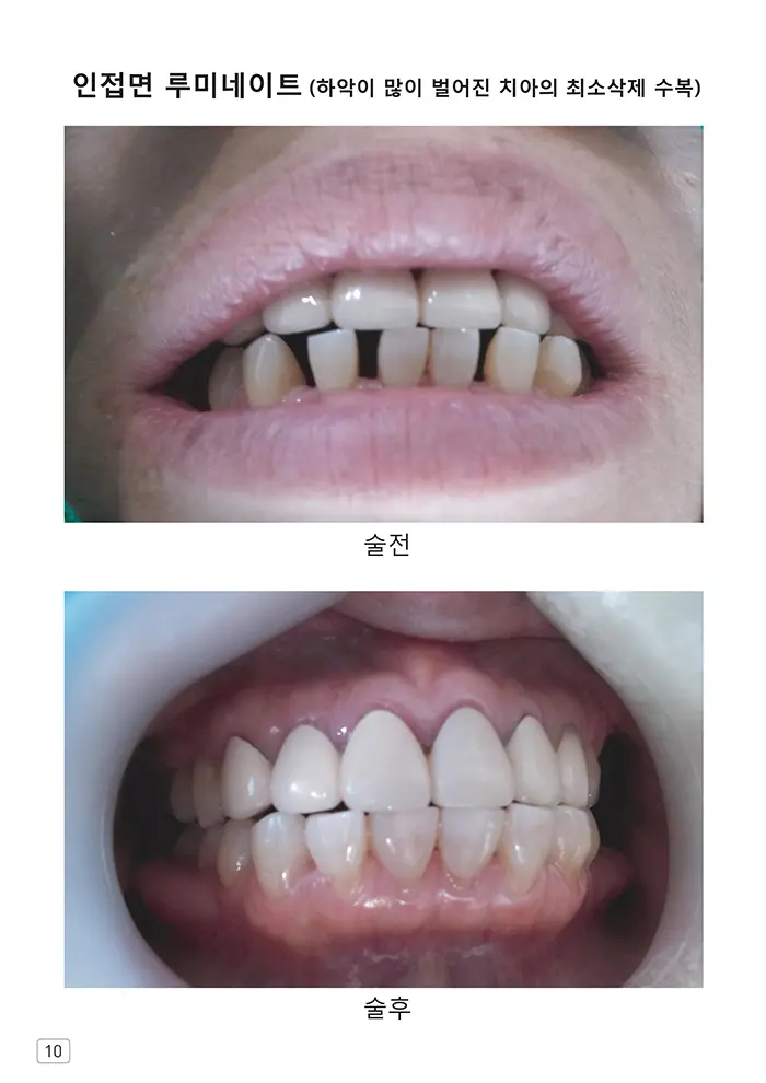 라인치과기공 임상사례집 수록 이미지 10
