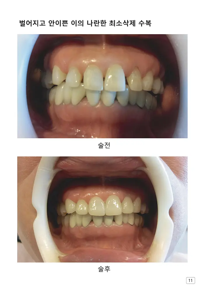 라인치과기공 임상사례집 수록 이미지 11