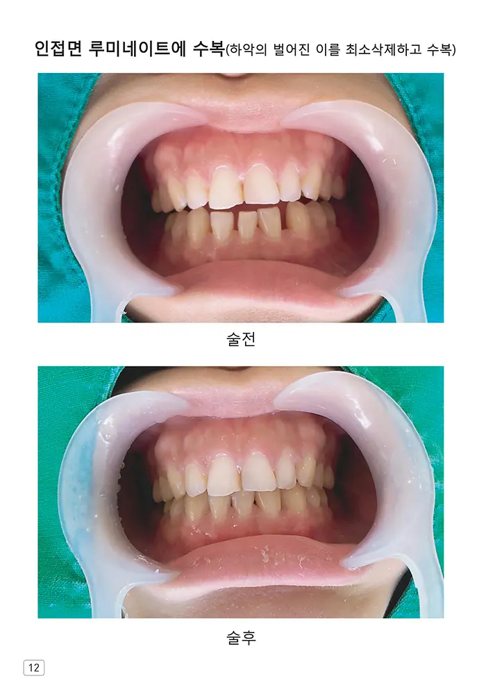 라인치과기공 임상사례집 수록 이미지 12