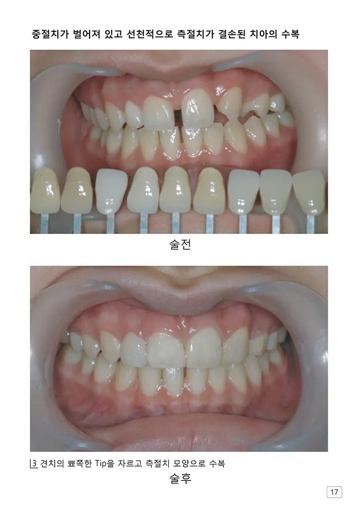 라인치과기공 임상사례집 수록 이미지 17