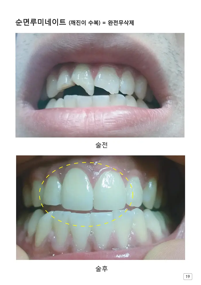 라인치과기공 임상사례집 수록 이미지 19