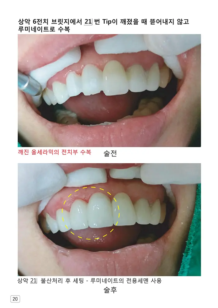 라인치과기공 임상사례집 수록 이미지 20