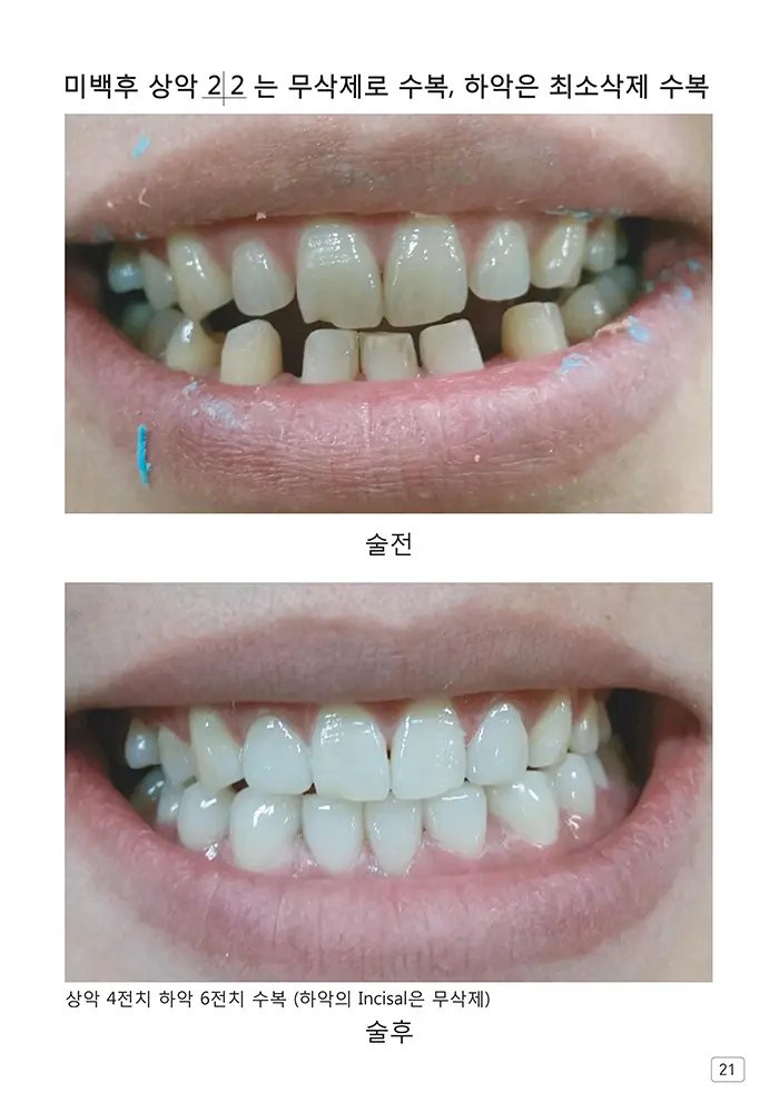 라인치과기공 임상사례집 수록 이미지 21