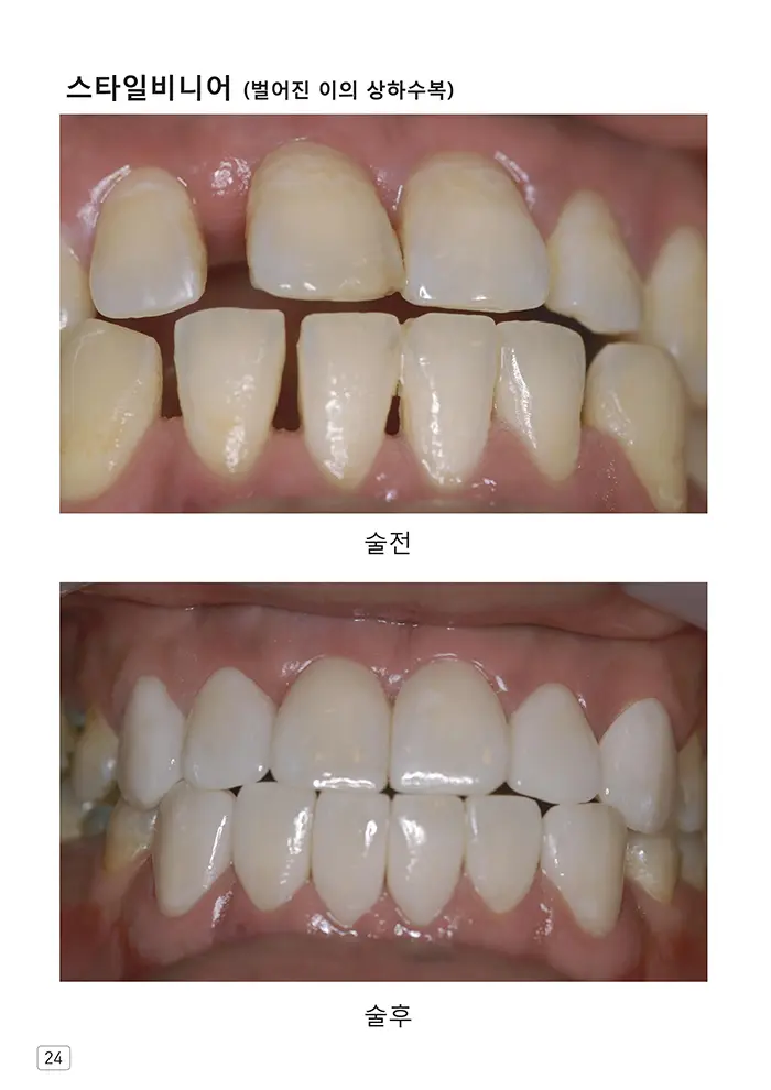 라인치과기공 임상사례집 수록 이미지 24