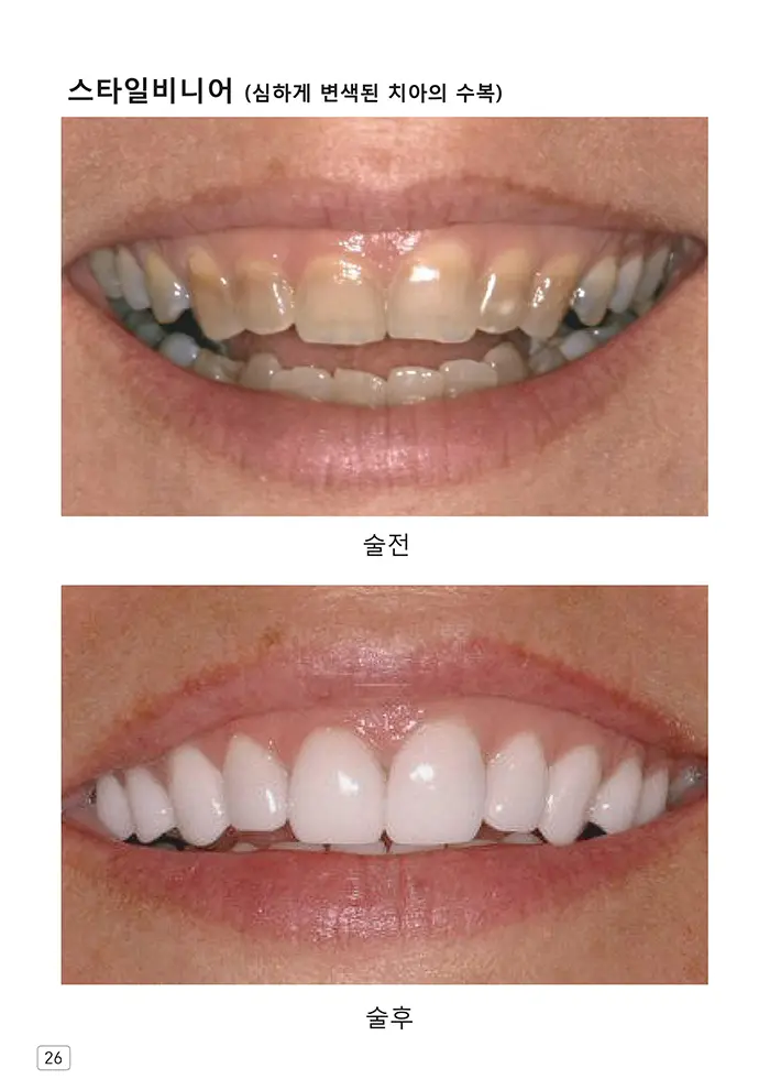 라인치과기공 임상사례집 수록 이미지 26