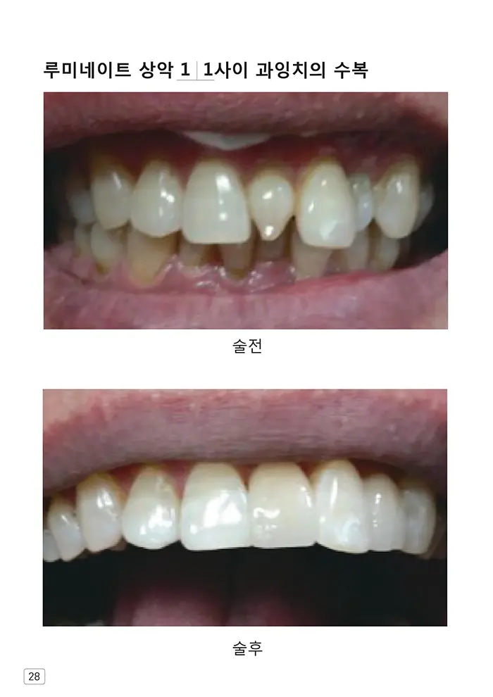 라인치과기공 임상사례집 수록 이미지 28