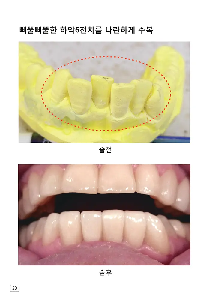 라인치과기공 임상사례집 수록 이미지 30