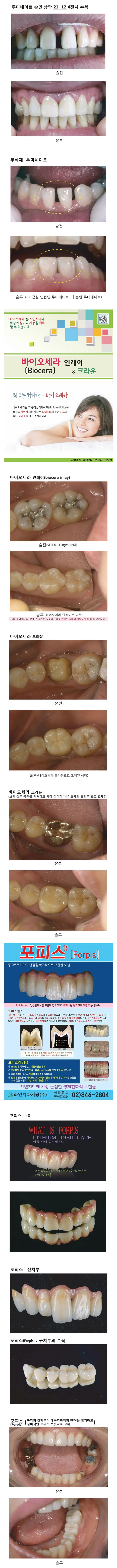 라인치과기공 임상사례집 수록 이미지 31