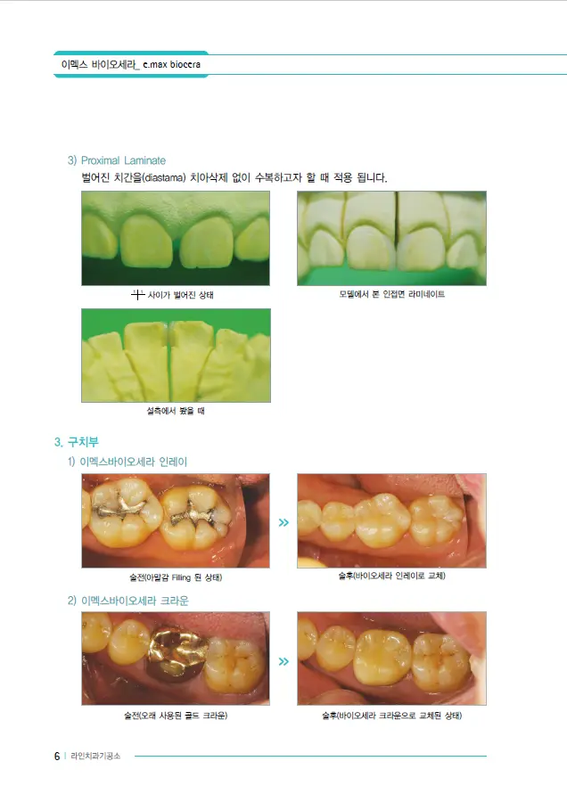 이멕스 바이오세라 임상 자료 이미지 6