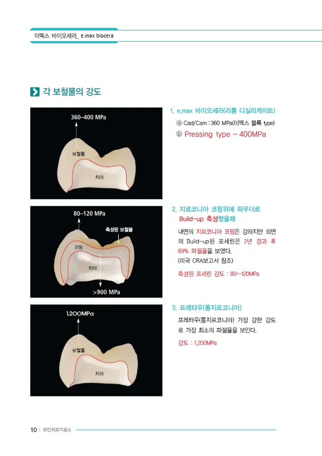 이멕스 바이오세라 임상 자료 이미지 10