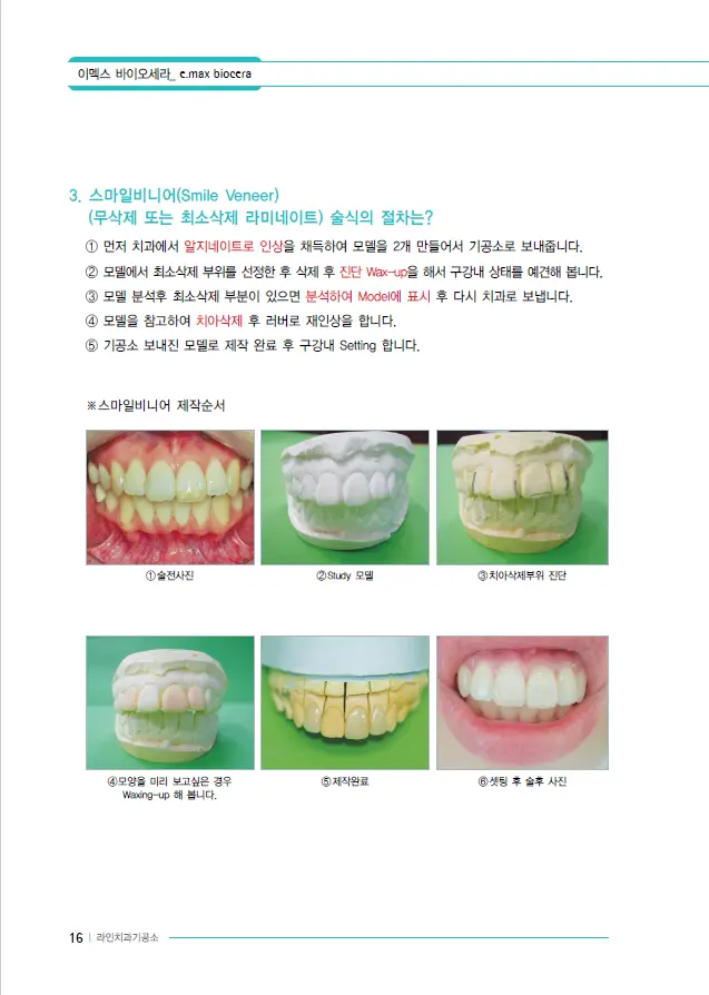 이멕스 바이오세라 임상 자료 이미지 16
