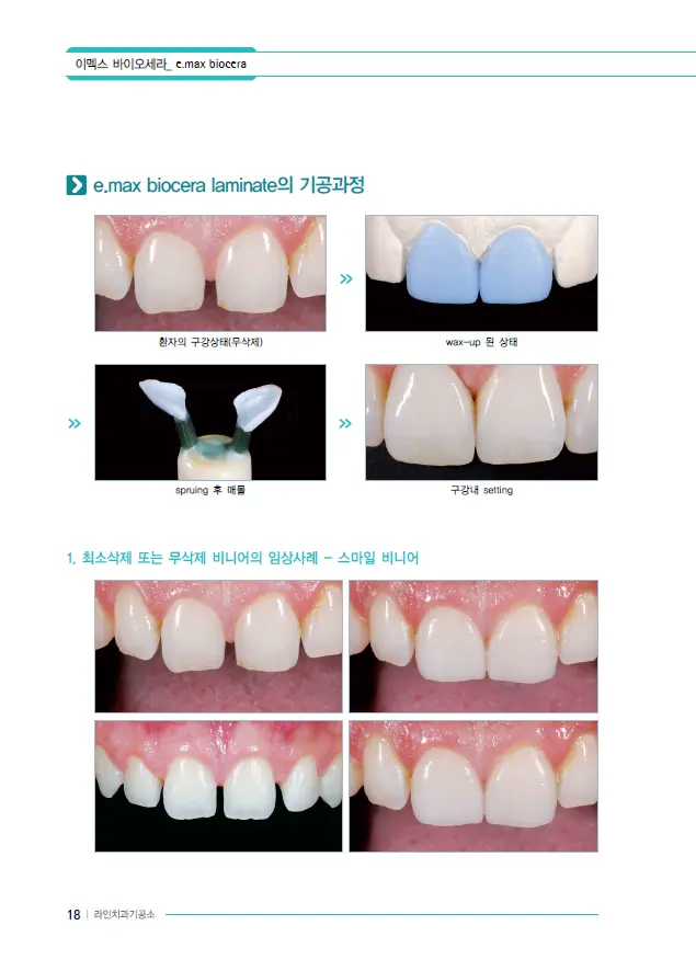 이멕스 바이오세라 임상 자료 이미지 18