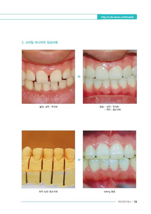 이멕스 바이오세라 임상 자료 이미지 19