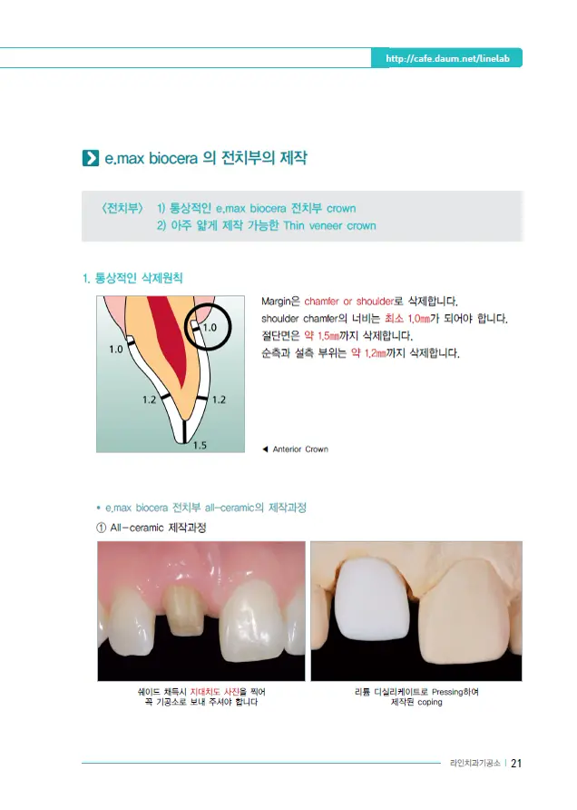 이멕스 바이오세라 임상 자료 이미지 21