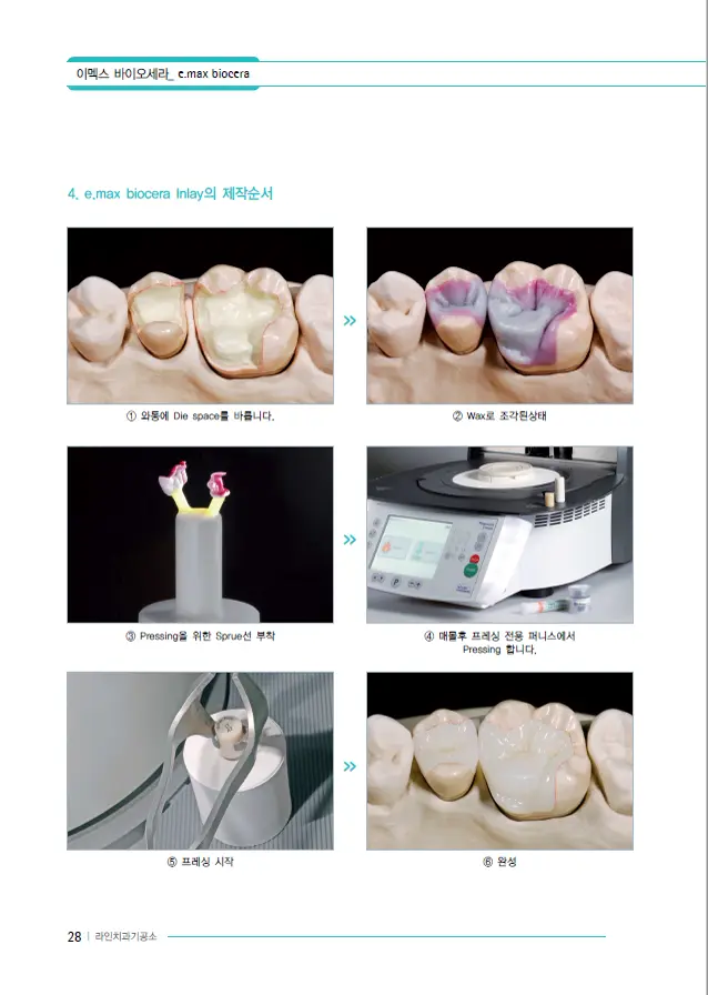 이멕스 바이오세라 임상 자료 이미지 28