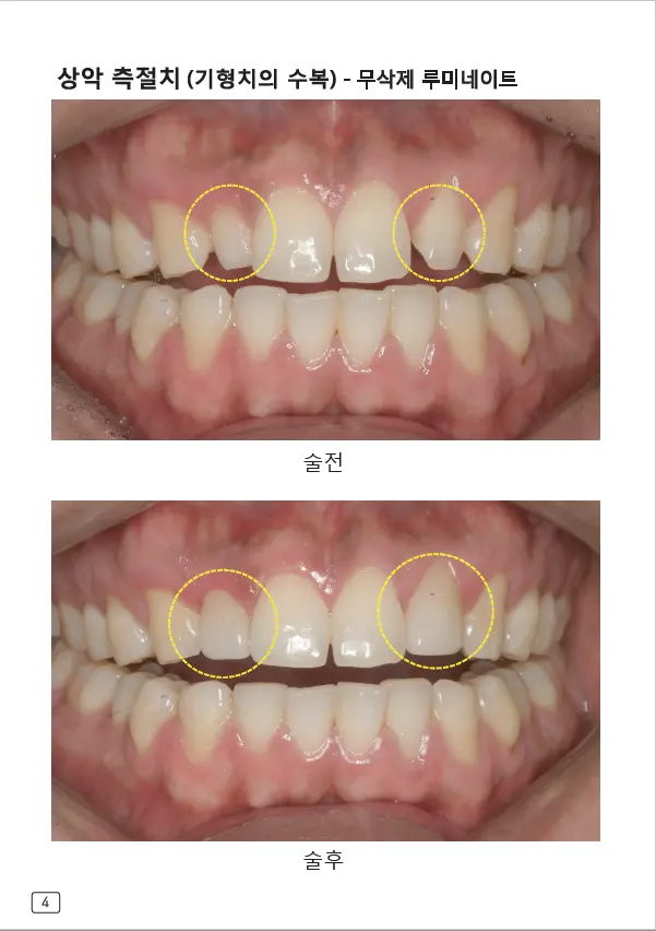 루미네이트 임상사례집 수록 이미지 4