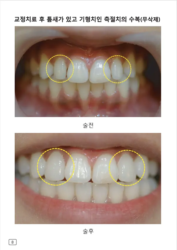 루미네이트 임상사례집 수록 이미지 8