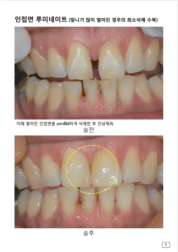 루미네이트 임상사례집 수록 이미지 9