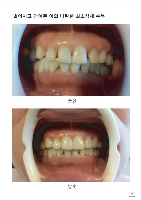 루미네이트 임상사례집 수록 이미지 11
