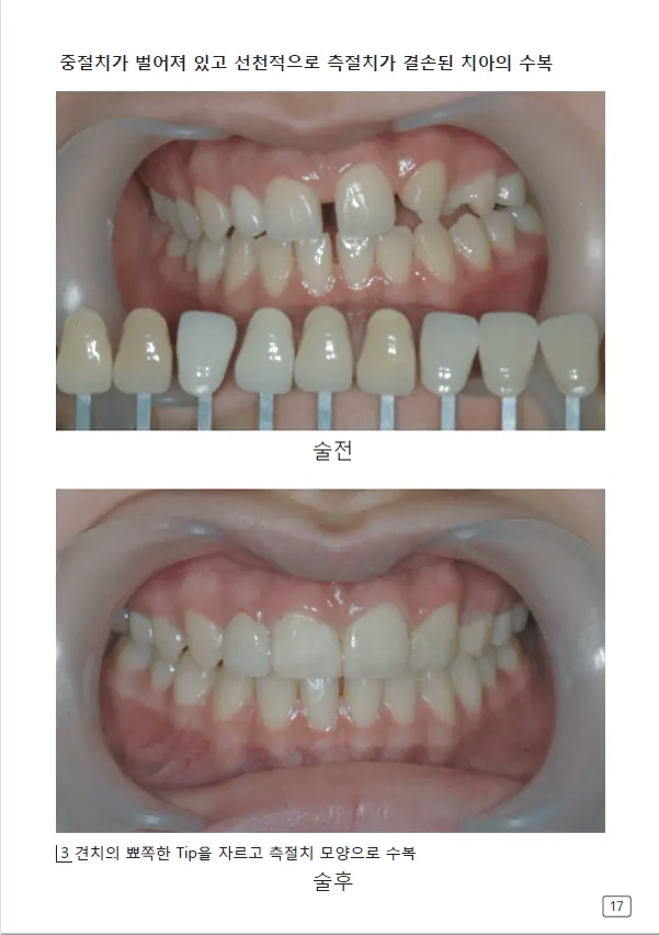 루미네이트 임상사례집 수록 이미지 17