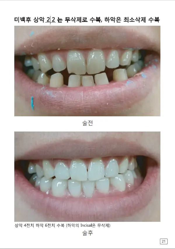 루미네이트 임상사례집 수록 이미지 21