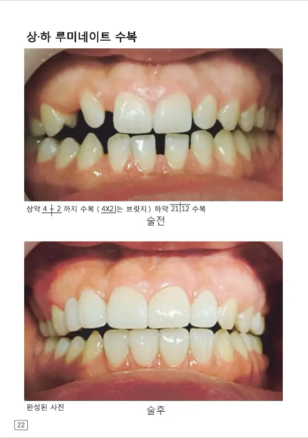 루미네이트 임상사례집 수록 이미지 22