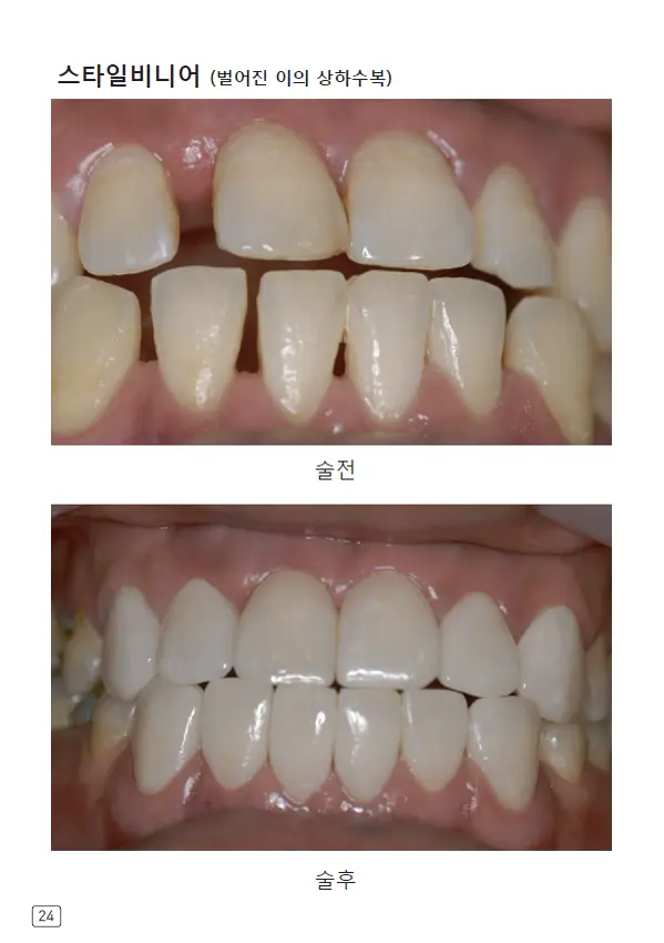 루미네이트 임상사례집 수록 이미지 24