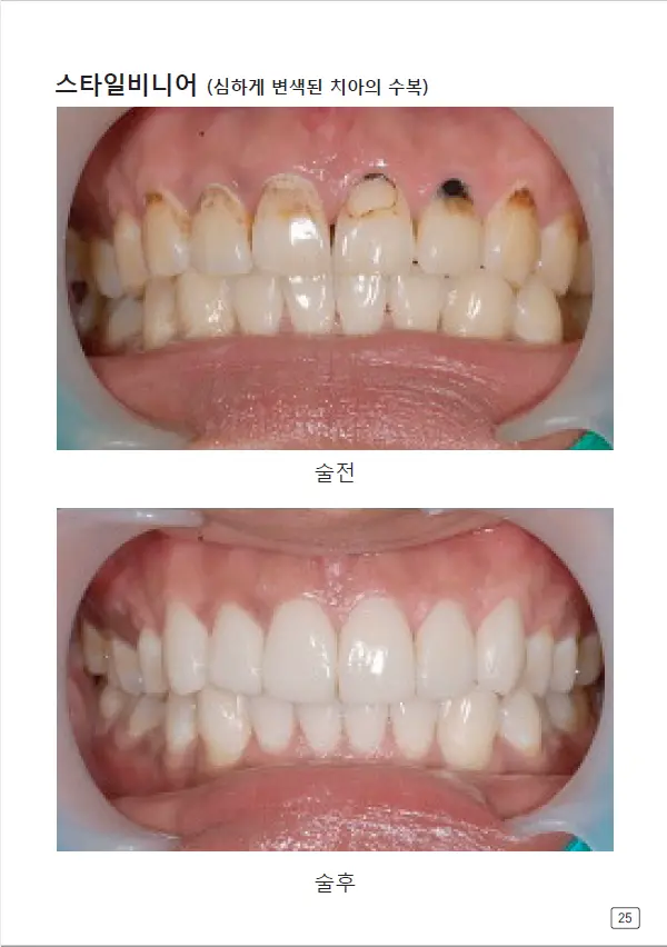 루미네이트 임상사례집 수록 이미지 25