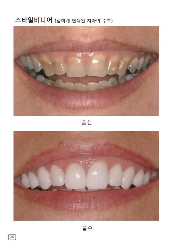 루미네이트 임상사례집 수록 이미지 26