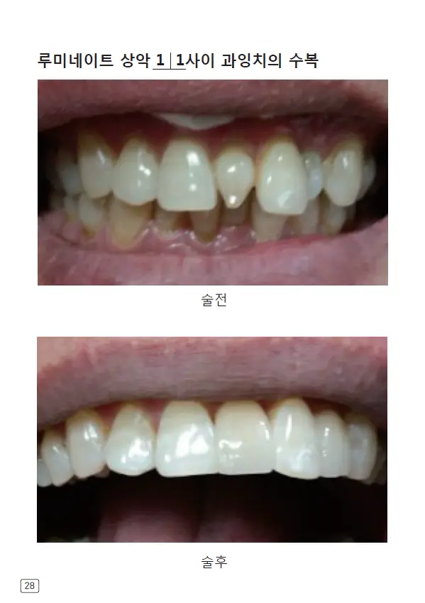 루미네이트 임상사례집 수록 이미지 28
