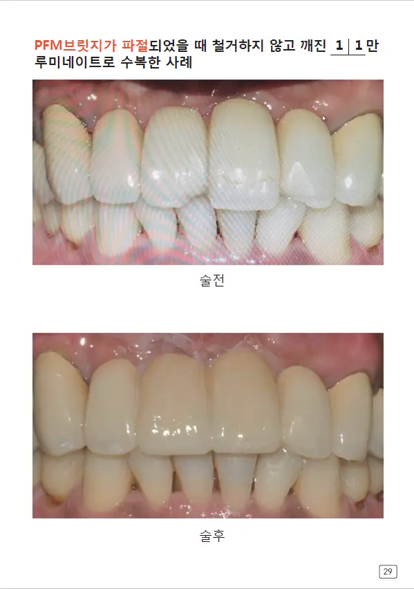 루미네이트 임상사례집 수록 이미지 29