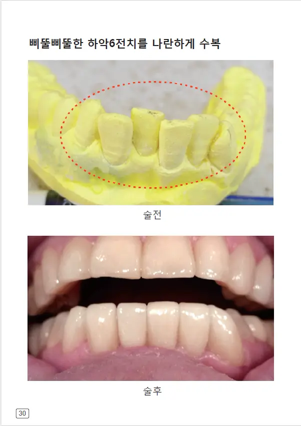 루미네이트 임상사례집 수록 이미지 30
