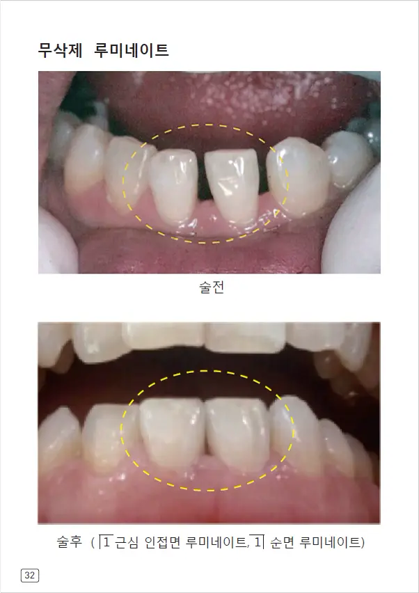 루미네이트 임상사례집 수록 이미지 32