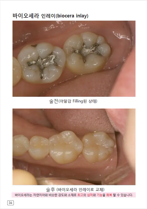 루미네이트 임상사례집 수록 이미지 34