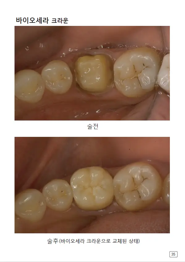 루미네이트 임상사례집 수록 이미지 35