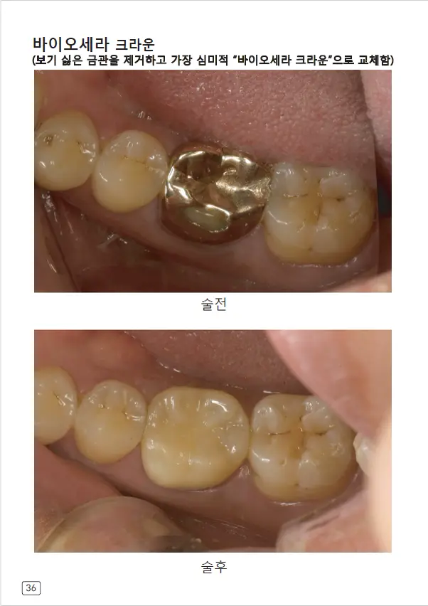 루미네이트 임상사례집 수록 이미지 36
