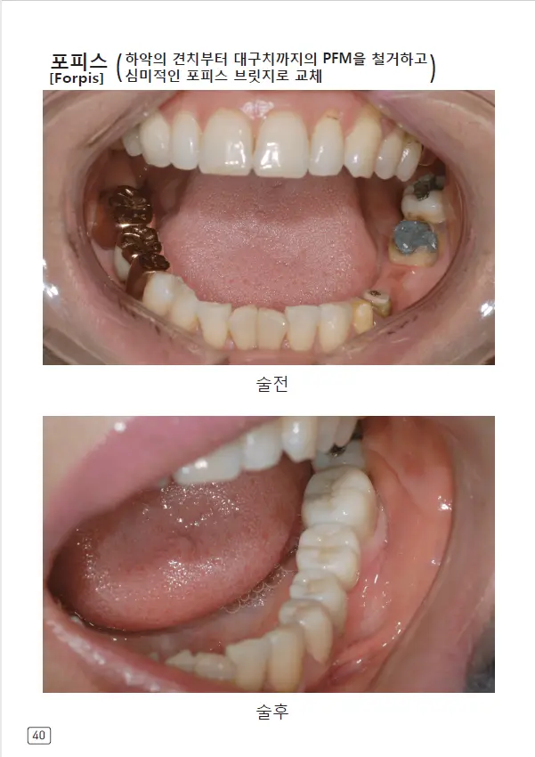루미네이트 임상사례집 수록 이미지 40