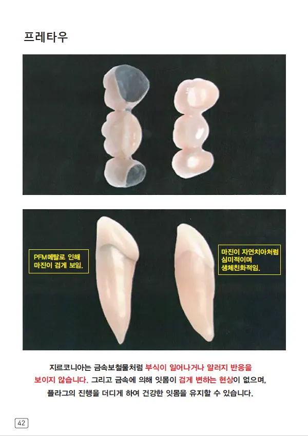 루미네이트 임상사례집 수록 이미지 42