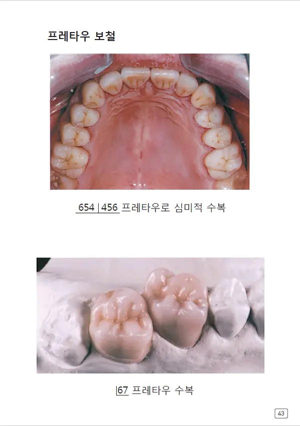 루미네이트 임상사례집 수록 이미지 43