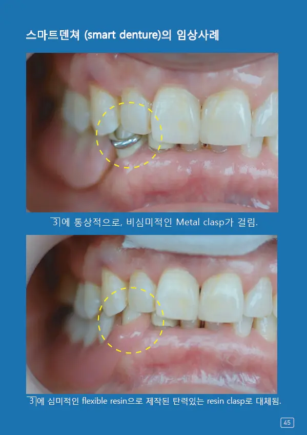 루미네이트 임상사례집 수록 이미지 45