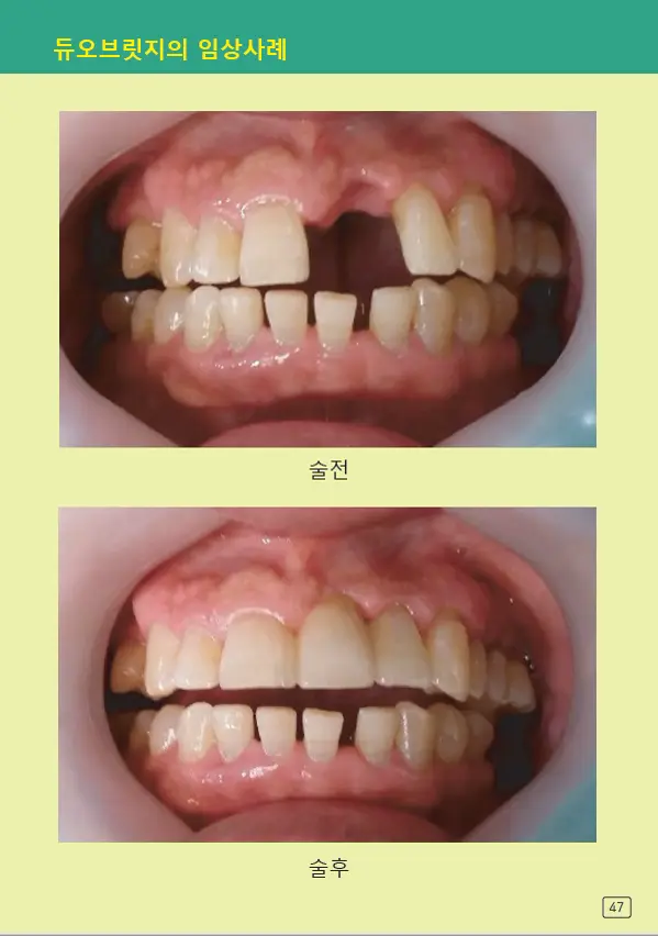 루미네이트 임상사례집 수록 이미지 47