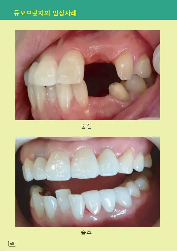 루미네이트 임상사례집 수록 이미지 48