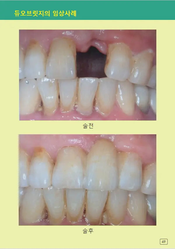 루미네이트 임상사례집 수록 이미지 49