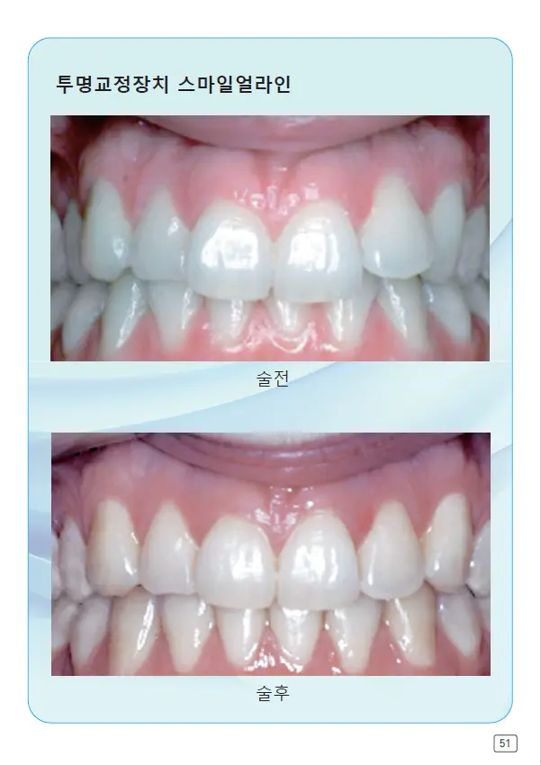 루미네이트 임상사례집 수록 이미지 51